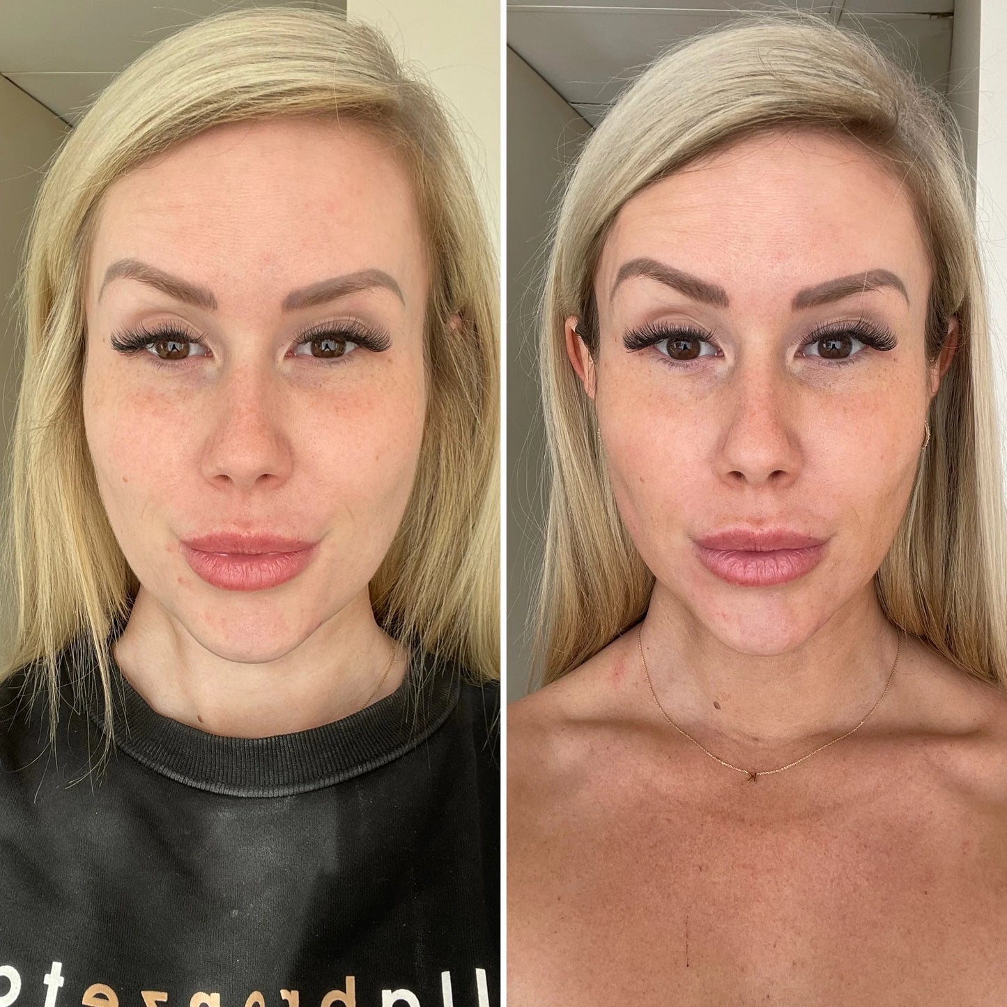 Bella Bronze | Face Tan Mist - Hinterland Skin